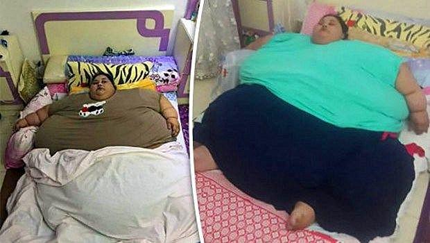 每天多睡一小时能否躺瘦？揭秘睡眠与体重的微妙关系