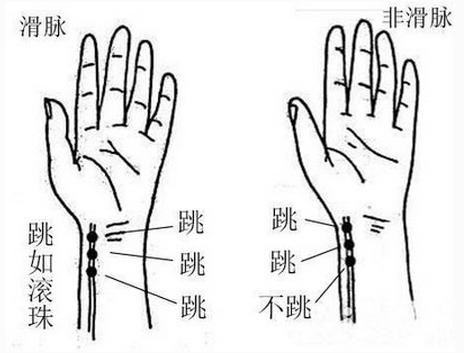 中医把脉揭秘伤心脉，探寻情感与健康之奥秘