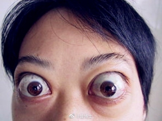 甲亢博主，引领健康潮流，传递正能量