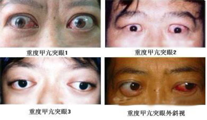 甲亢主播，网络时代的新声音