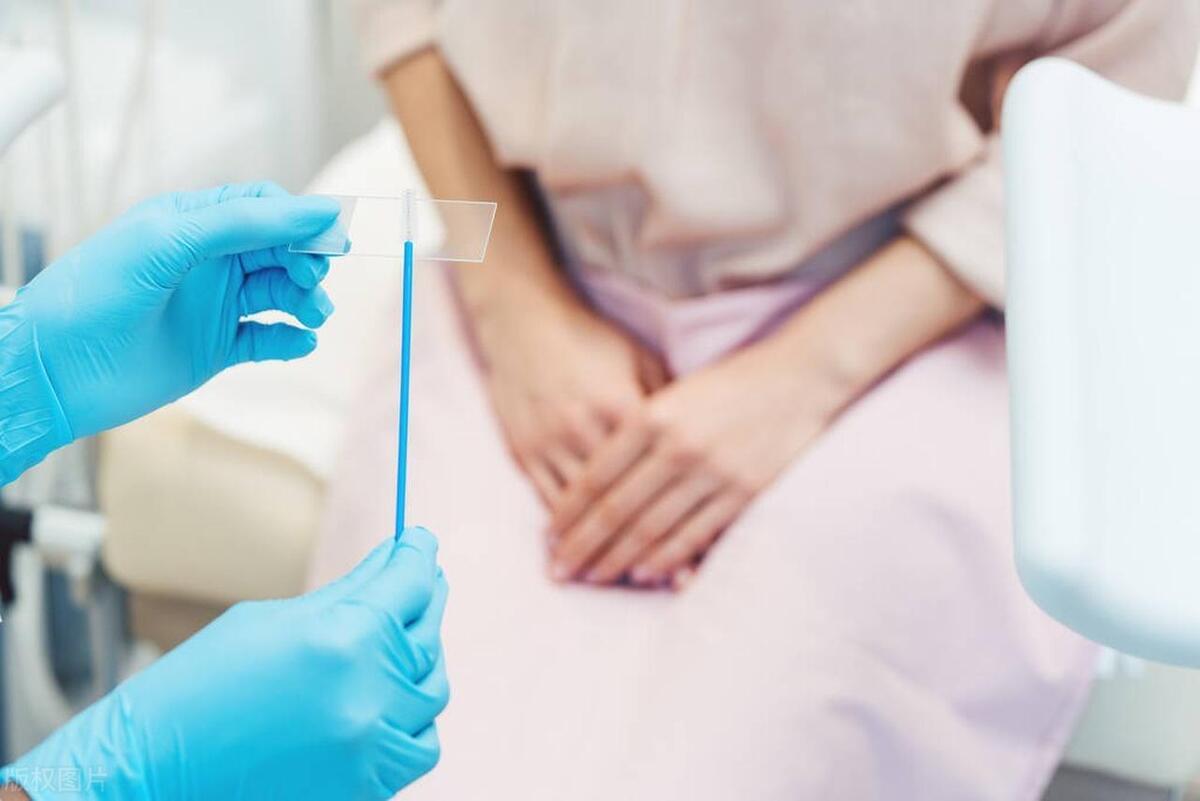 口腔溃疡与感染HPV有关联吗？深度解析