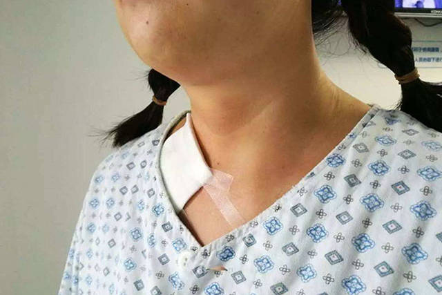 年轻女孩得了甲亢，如何治愈？