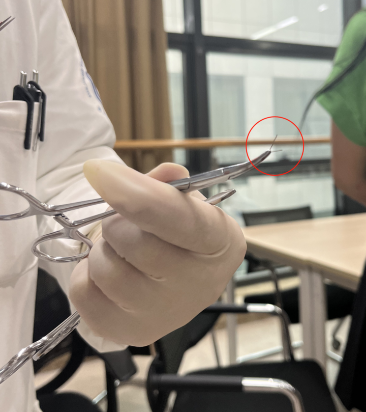 挤痘痘玩具内含针头，安全与娱乐的边界探究