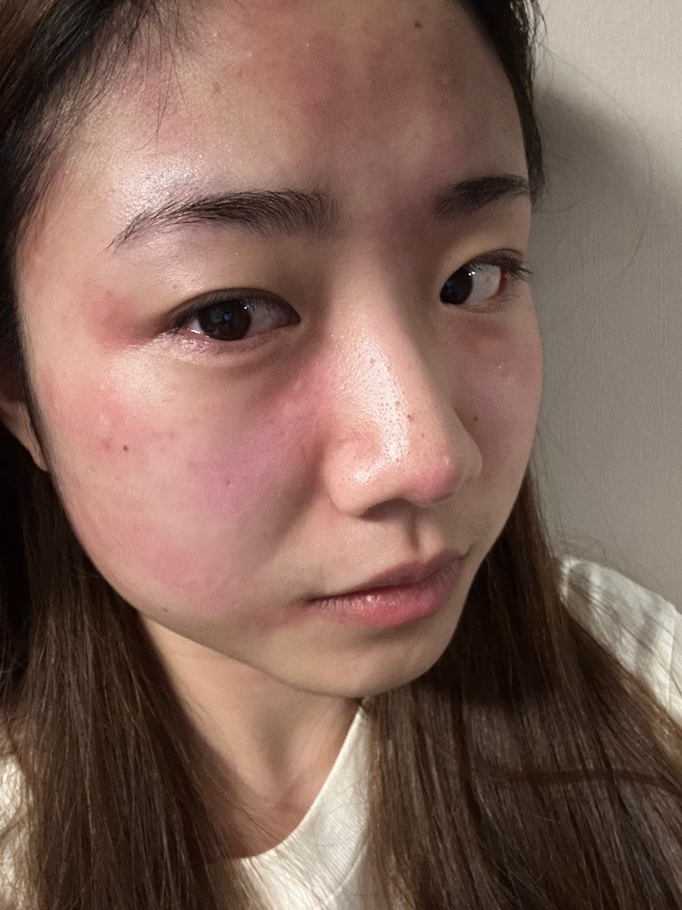 过敏是一种状态