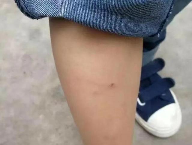 悲痛的瞬间，8岁男孩遭遇恶犬袭击的悲剧