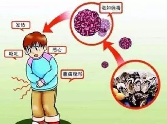 女子使用话筒后感染单纯疱疹病毒