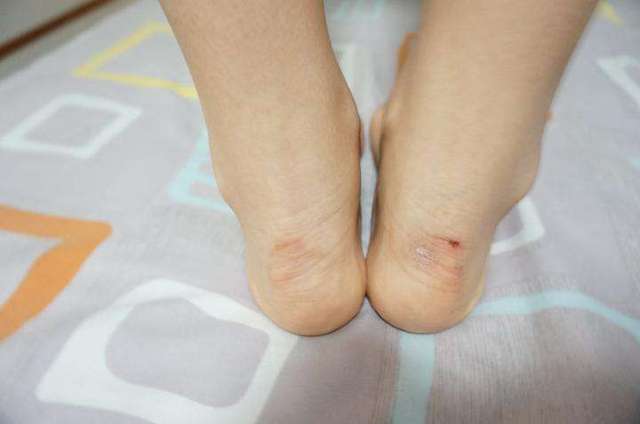女生说鞋磨脚，怎么办？一篇全方位解析的文章