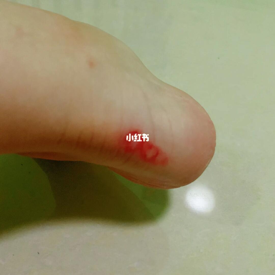 女生说鞋磨脚，怎么办？一篇全方位解析的文章