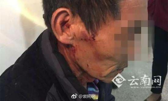 男子被打致死家属获赔200万事件深度解析