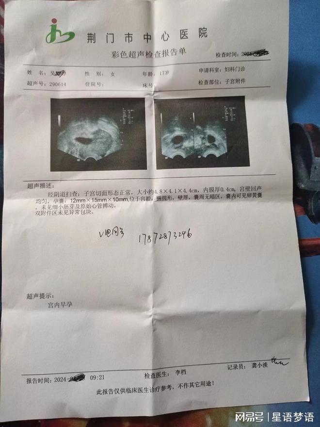 女子做流产手术7个月后确诊癌症，逆境中的希望与挑战