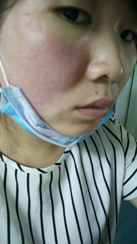 输液头孢过敏对身体危害大吗？全面解析