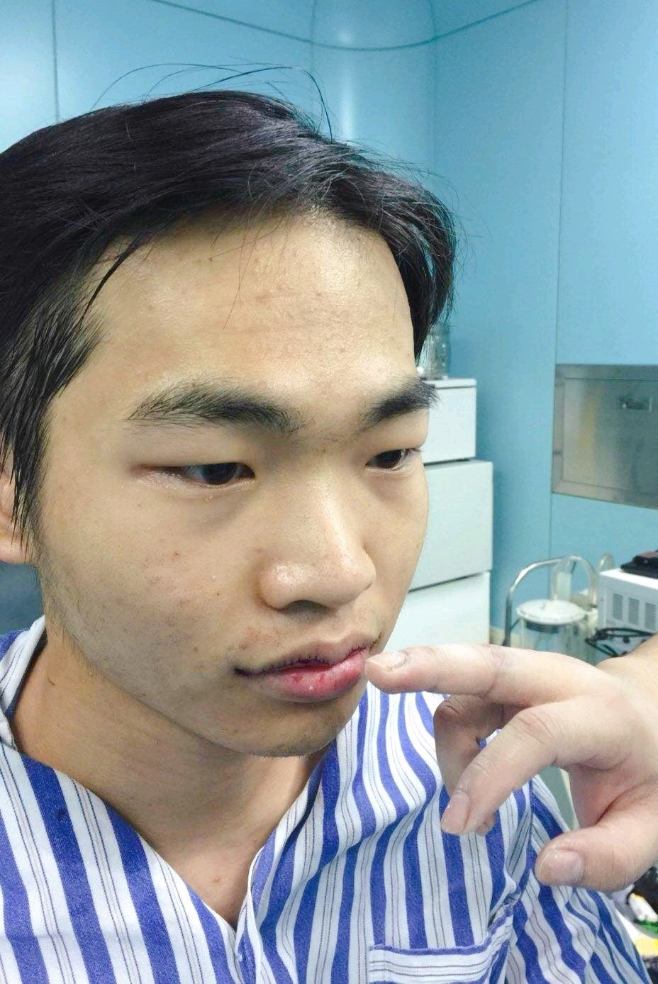 男子突然变丑，下唇比上唇厚一倍，背后的故事引人深思
