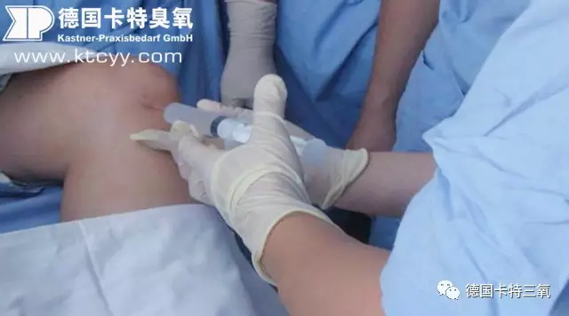 女子因长期皮下注射激素确诊骨坏死，成因、影响与应对之道