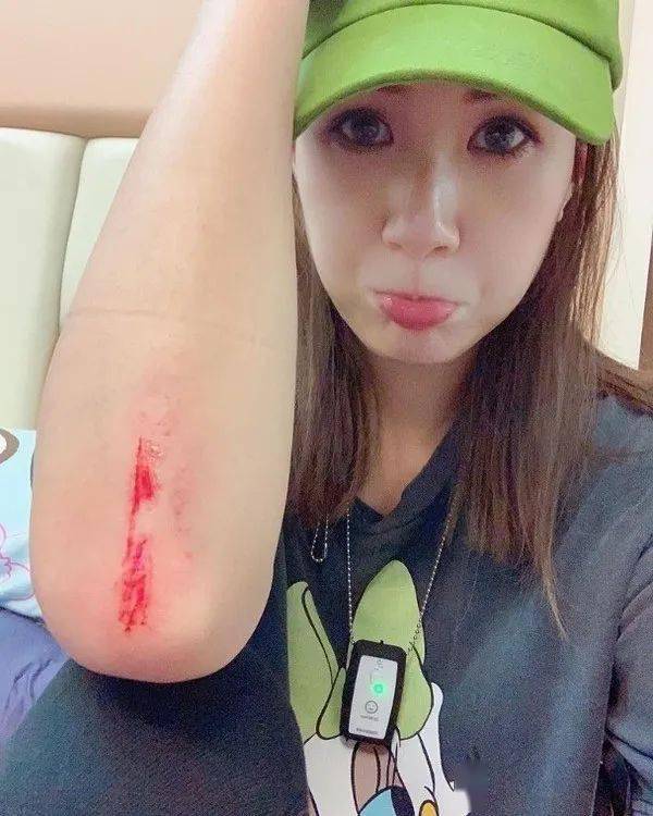贵州遭遇极端天气，女演员拍戏受伤，逆境中的坚韧与力量