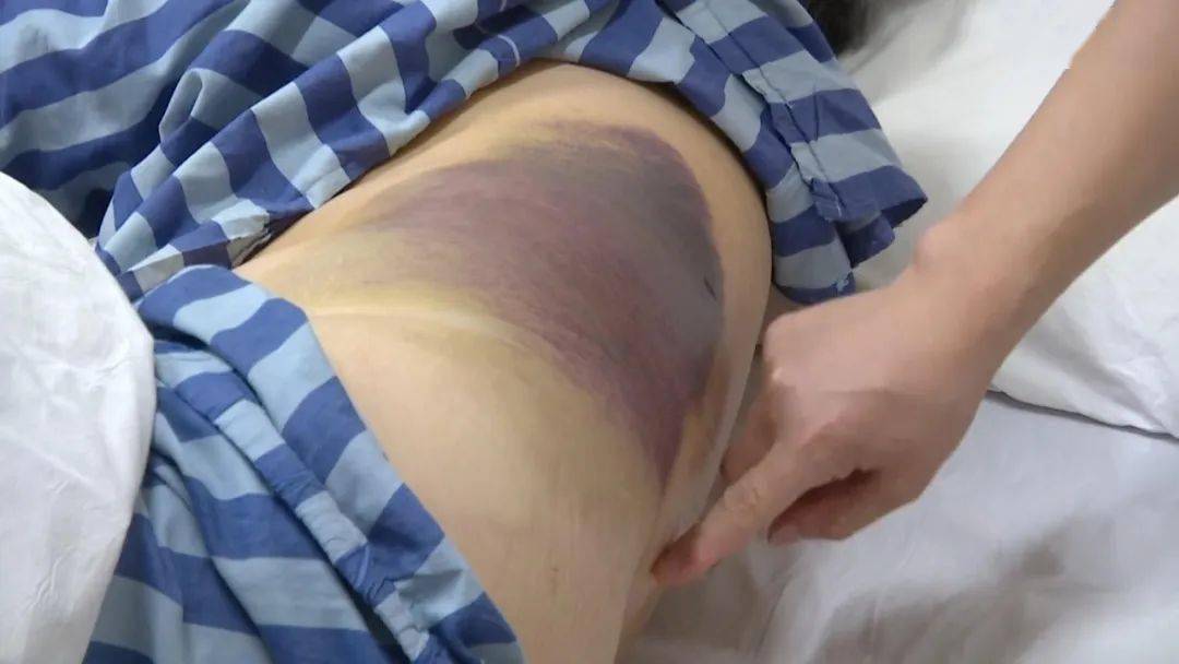 撞树锻炼会导致椎体坏死吗？解析背后的真相与风险
