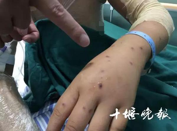 悲剧降临，一群蜜蜂飞入家中，4岁女童遭遇不幸身亡