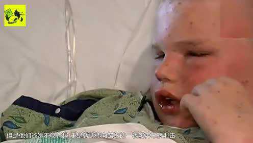 女童被蜜蜂蛰伤致死，悲剧背后的警示与反思