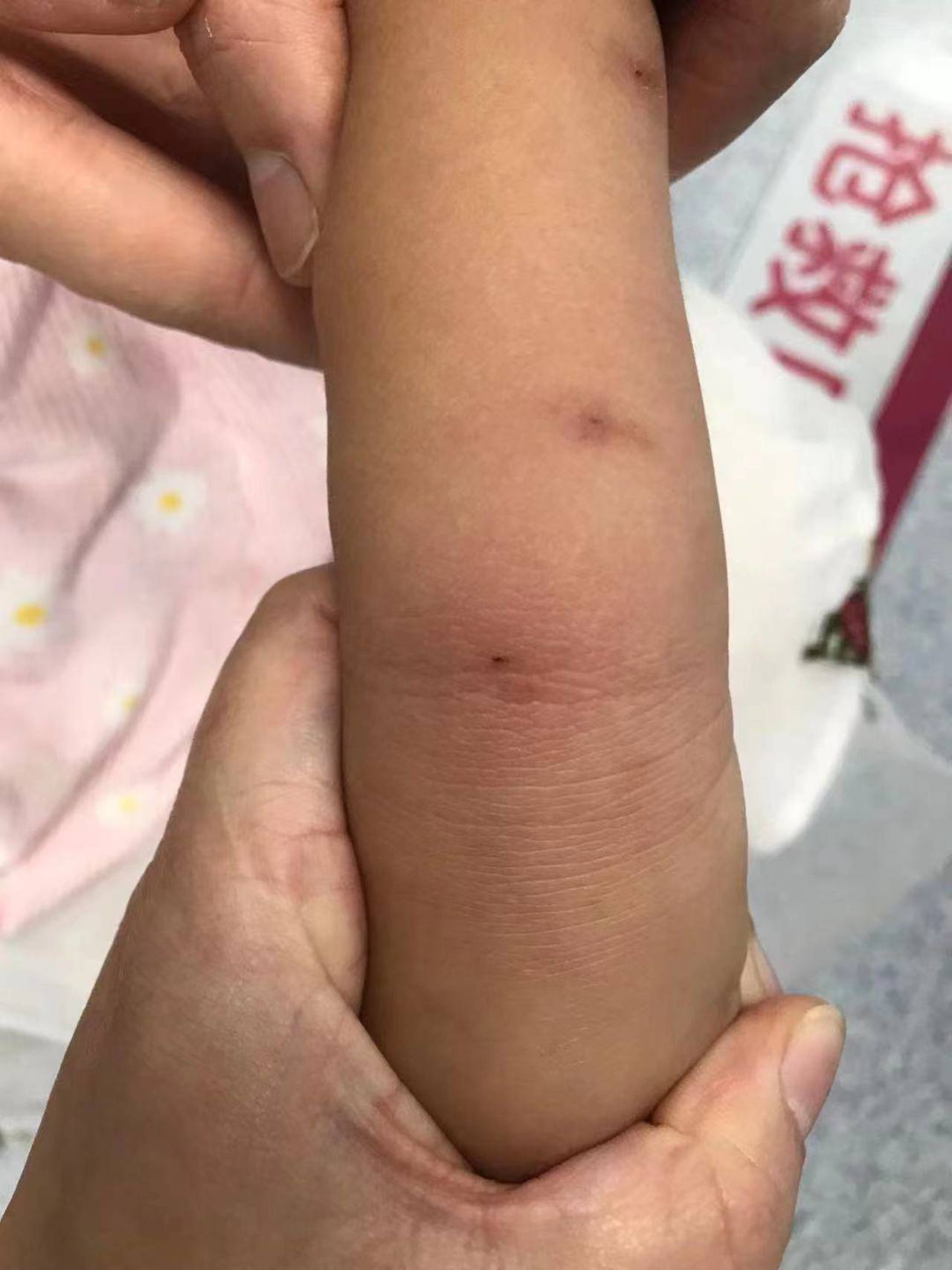 痛失爱女，4岁女童遭蜜蜂蜇伤致死，爸爸的哭诉引发社会深思