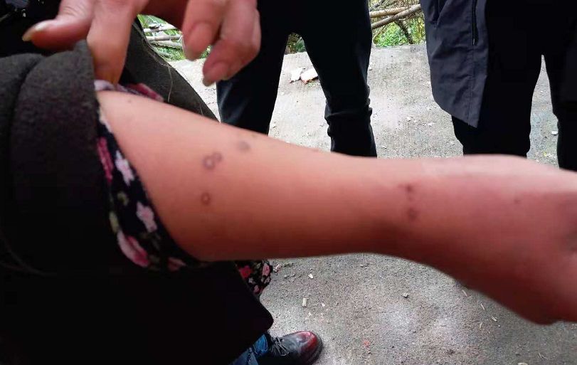 痛失爱女，4岁女童遭蜜蜂蜇伤致死，爸爸的哭诉引发社会深思