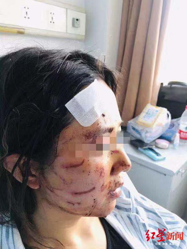 温州女子被打最新消息事件深度解析
