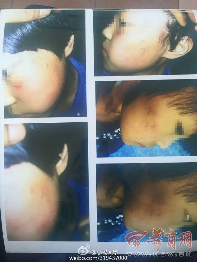 深度解析4名老师打女童被拘事件