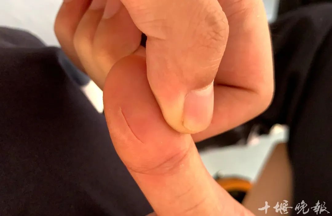 多位捏捏玩家出现喉咙痛烂手指——游戏健康隐患探讨