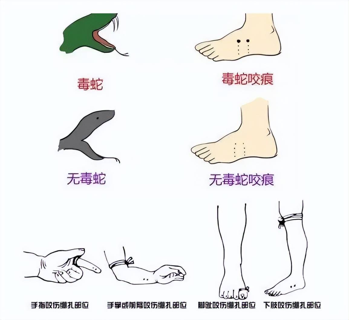 博主推测三亚女子可能被银环蛇咬伤事件分析