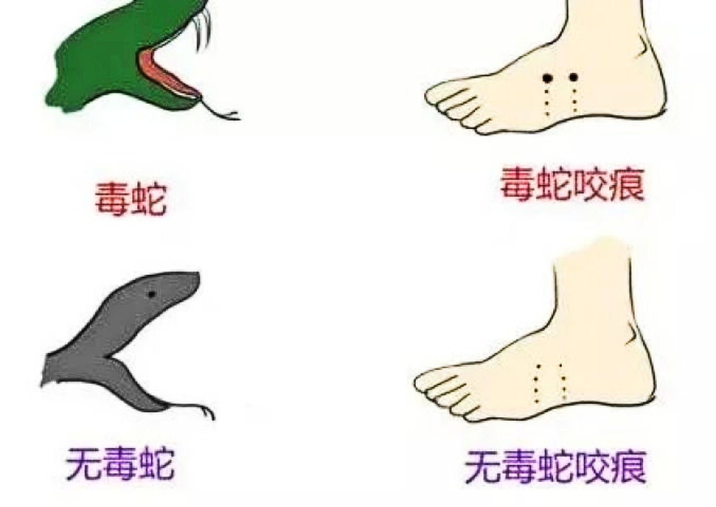 关于被蛇咬一年后还有毒吗的解析