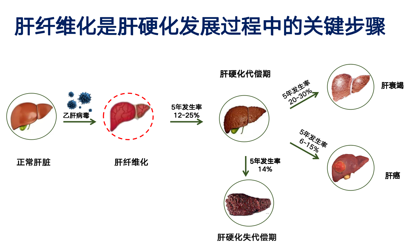肝纤维化是一种什么病？需要治疗多少钱？全面解读