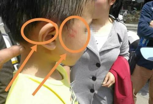 熊孩子一家飞机上打人:他还是孩子熊孩子一家飞机上打人事件，年龄不是逃避责任的借口